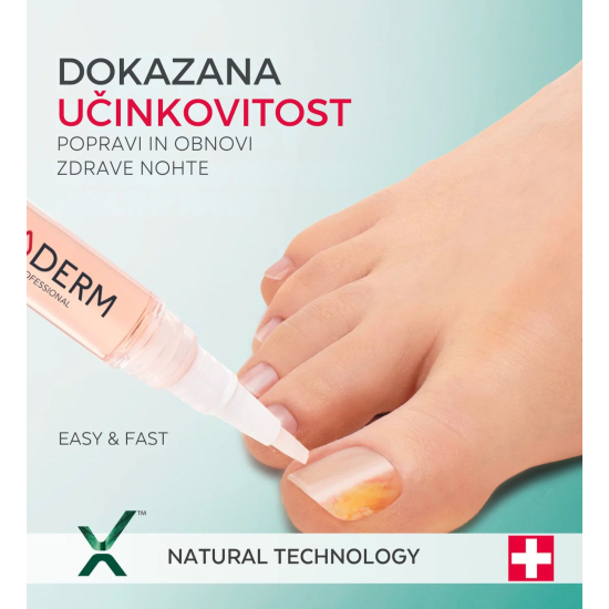 Slika produkta PODERM® Serum – pero proti glivicam na nohtih