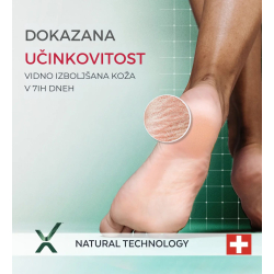 PODERM® Serum za zelo suha in poškodovana stopala, 75 ml PODERM® Serum za zelo suha in poškodovana stopala, 75 ml