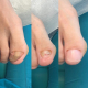 Showing image of Nails Aesthetic Composite® (NEC) Starter Kit Nails Aesthetic Composite® (NEC) Starter Kit image