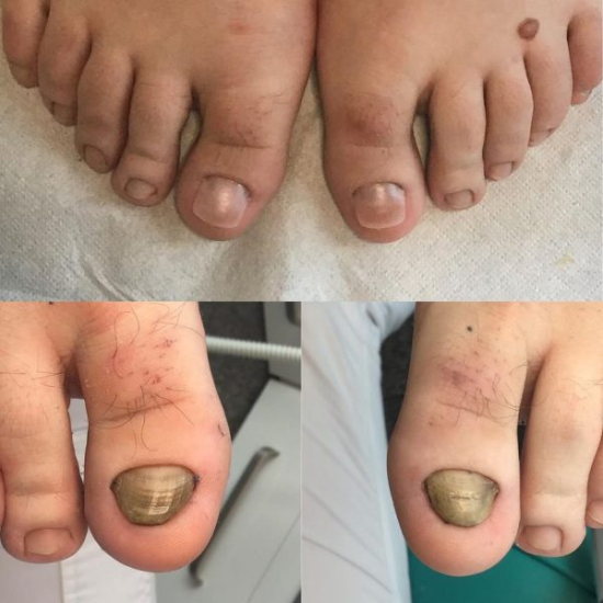 Showing image of Nails Aesthetic Composite® (NEC) Starter Kit Nails Aesthetic Composite® (NEC) Starter Kit image
