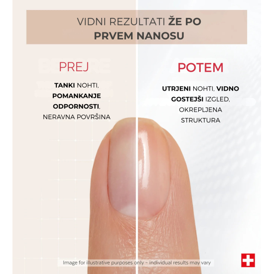 Showing image PODERM® Corrective nail polish with keratin, 8 ml Product image PODERM® Corrective nail polish with keratin, 8 ml