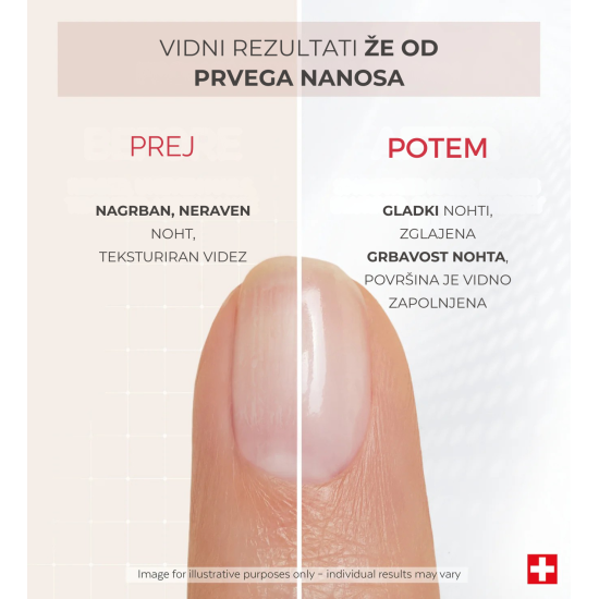 Slika produkta PODERM® Korektivni lak za nohte s kolagenom, 8 ml