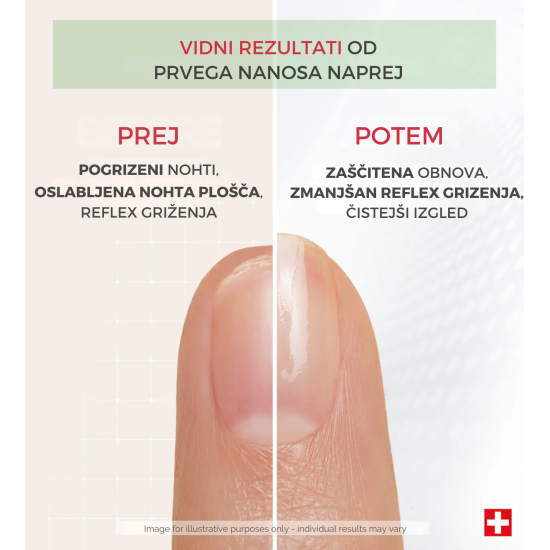 Prikazujem sliko PODERM® Korektivni lak za nohte s proteini, 8 ml Slika produkta PODERM® Korektivni lak za nohte s proteini, 8 ml