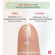 Prikazujem sliko PODERM® Korektivni lak za nohte s proteini, 8 ml Slika produkta PODERM® Korektivni lak za nohte s proteini, 8 ml