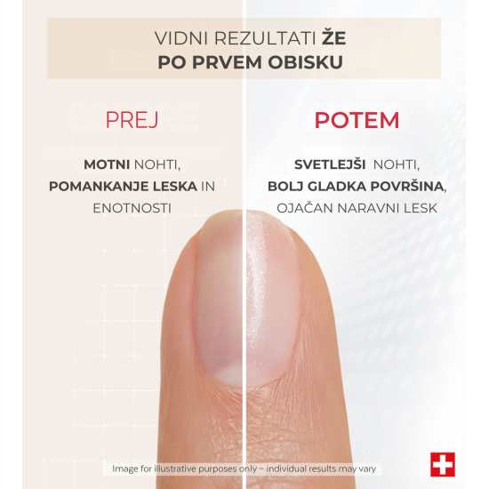 Slika proizvoda PODERM® Korektivni lak za nokte s mineralnim sjajem, 8 ml
