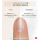Slika proizvoda PODERM® Korektivni lak za nokte s mineralnim sjajem, 8 ml