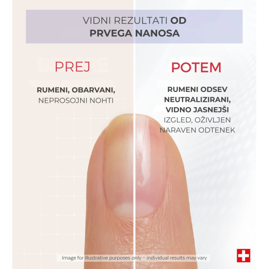 Prikazana slika PODERM® Korektivni lak za nokte za neutralizaciju žutih noktiju, 8 ml Slika proizvoda PODERM® Korektivni lak za nokte za neutralizaciju žutih noktiju, 8 ml
