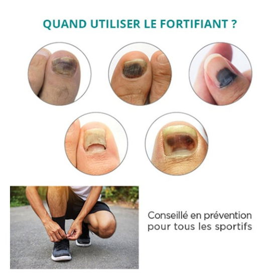 Prikazujem sliko PODERM® Serum za poškodovane nohte in hematome (8ml) Slika produkta PODERM® Serum za poškodovane nohte in hematome (8ml)