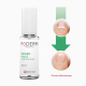 Prikazujem sliko PODERM PAKET ( Purifiant, 8 ml + Nourissant, 8 ml ) Slika produkta PODERM PAKET ( Purifiant, 8 ml + Nourissant, 8 ml )